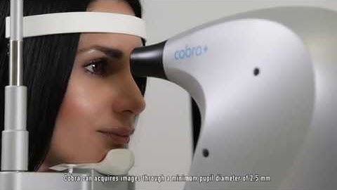 Cobra+ - Technical Features