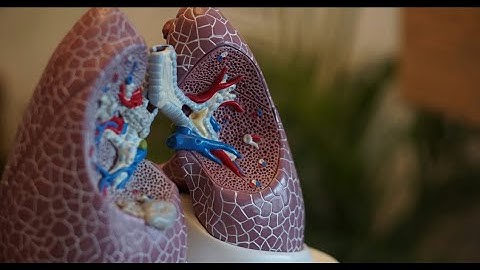 IMRT Optimization Method for Patients with Lung Cancer Using Firefly and Genetic Algorithms