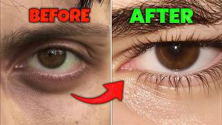 Attractive Eyes for Men in 7 Days 😳 | Eye Area Looksmaxxing Guide | Hindi Attractive Eyes for Men in 7 Days 😳 | Eye Area Looksmaxxing Guide | Hindi
