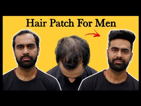 Hair Wigs in Delhi | Hair Patch in Delhi | Malhotra Hair Replacement