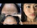 ”iTs FAcEtUnEd” skincare routine!!