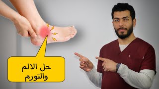 تمارين علاج التواء الكاحل|| حل مشكلة الم وتورم القدم او الكاحل اثناء المشى او الجرى