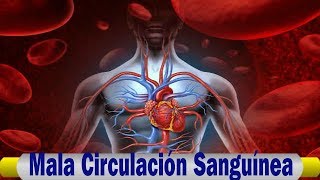 Sanguínea circulación cómo mala