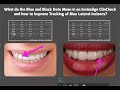 How to Improve Tracking of Max Lateral Incisors and what are the Blue and Black Dots in ClinCheck?