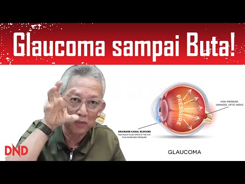 Glaucoma sampai Buta! secara diam-diam