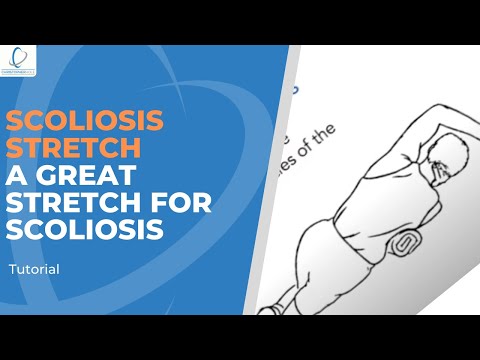 What Scoliosis Exercise Pdf