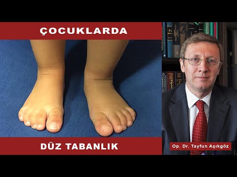 Video: Bir çocukta Düz Ayak Nasıl Belirlenir