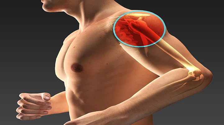 What are Shoulder Labrum Tears and How Are They Tr...