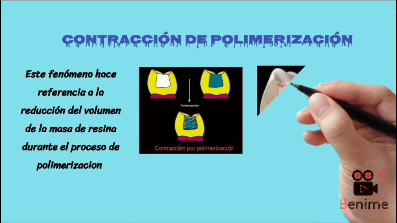 Contracción de la polimerización