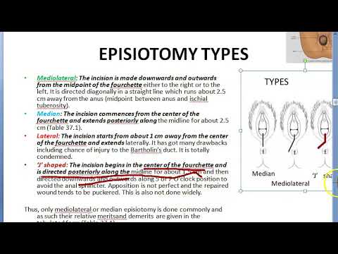 Obstetrics 669 d Episiotomy Types Different Compare Difference Median