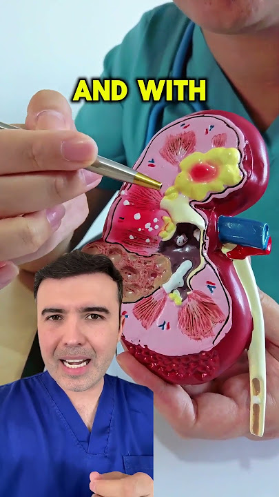 Foaming urine? Watch out for this sign from your body! 🚨 #didyouknow