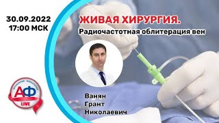 Радиочастотная абляция на АФ Live 30/09/2022