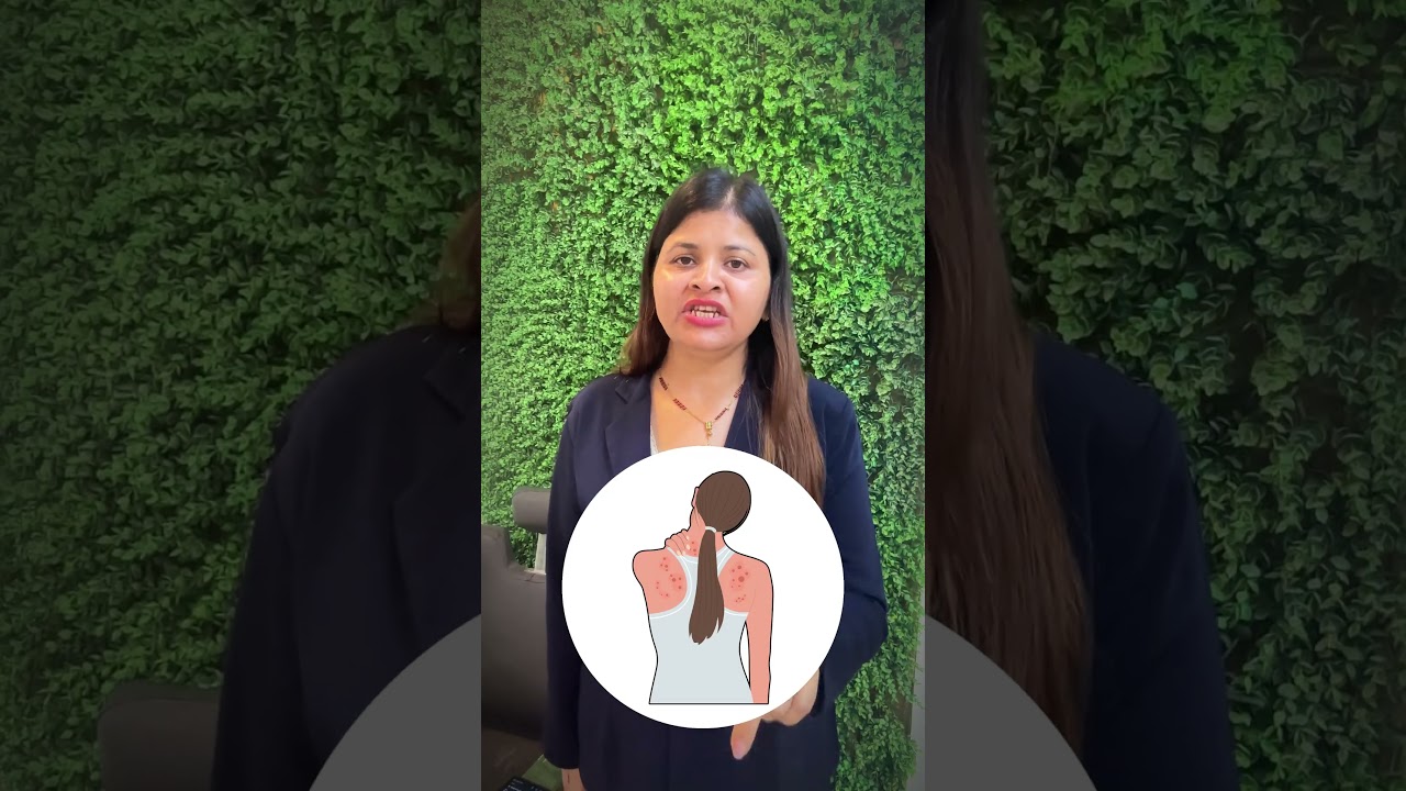 Say Goodbye to Pimple & Fungal Infection Salon By Uma Purohit Indore