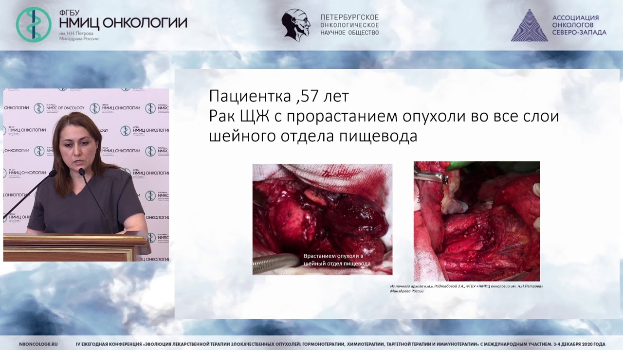 Системная терапия рака щитовидной железы по итогам 2020 года (Раджабова ...