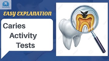 Caries Activity Tests: Easy Explanation!!
