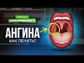 При ангине нужно колоть антибиотик или достаточно полоскать горло?