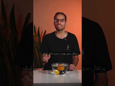 حتما ما رو دنبال کن و مشکلات فیزیکت رو بفرست تا حل اش کنیم