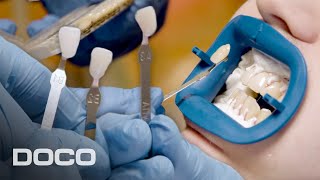 Dentist Whitens Patient's Teeth During an EXTREME Smile Makeover! | The Tooth Doctors
