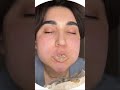 #asmr #asmr