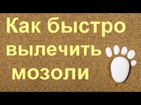 Как быстро вылечить мозоли на ногах...