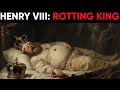 Henry VIII's REAL Death: The SHOCKING Medical Truth Buried for Centuries.