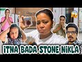Itna bada stone nikla   bharti singh  haarsh limbachiyaa  golla