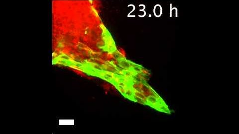 Confocal movie of leader cell invasion