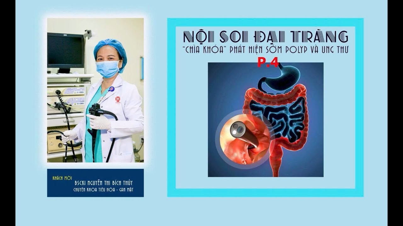 NỘI SOI ĐẠI TRÀNG 