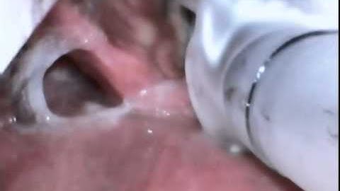 A first look at the UEscope from AOD