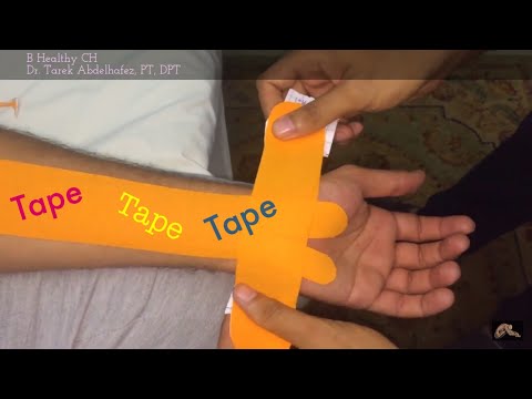 فيديو: كيفية استخدام شريط كينيسيو لمتلازمة النفق الرسغي: 12 خطوة