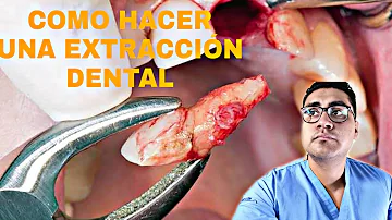 ¿Qué hacen los dentistas con los dientes que extraen?