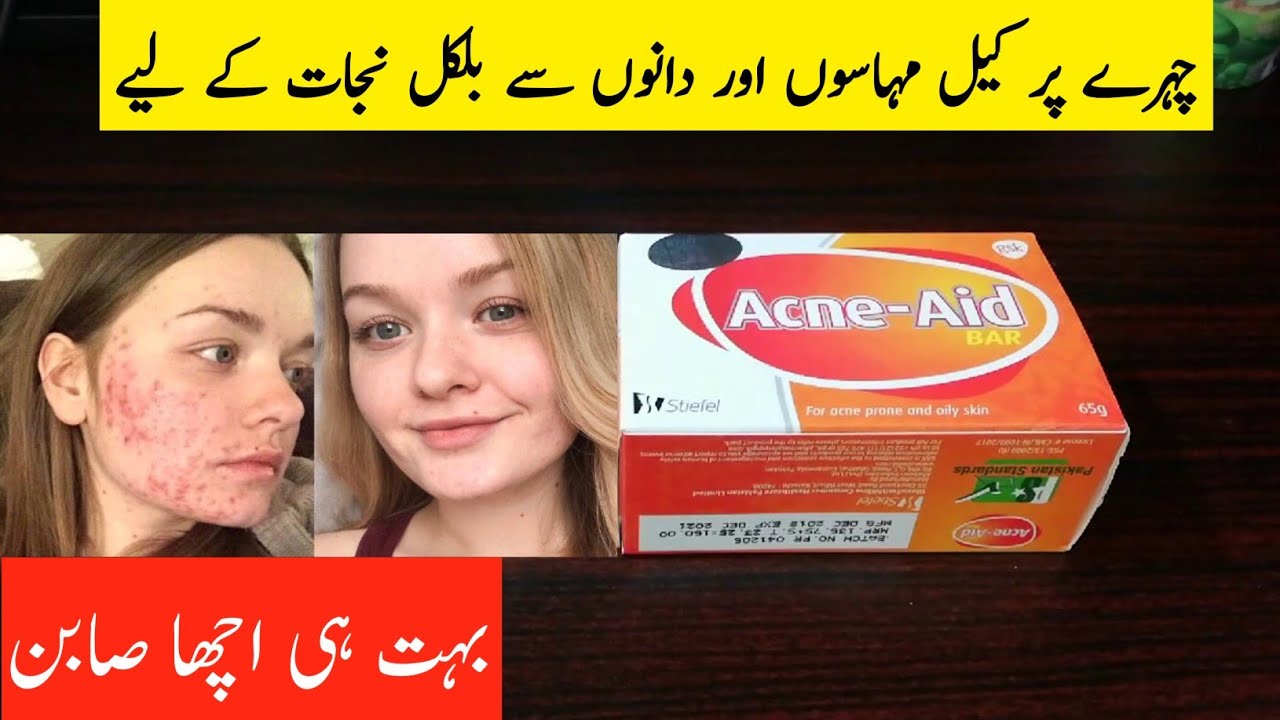 Which is the best soap for acne | Acne Aid Soap review in Urdu | Health and beauty Secrets