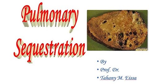Pulmonary Sequestration