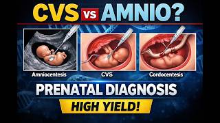 Prenatal Diagnosis Made EASY | Amniocentesis vs CVS vs Cordocentesis (Must Know for Exams!)
