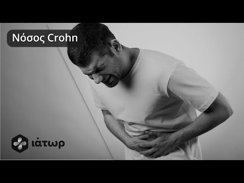 Νόσος Crohn - Crohn&rsquo;s Disease