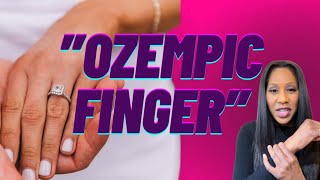 What is “Ozempic Finger?”  A Doctor Explains