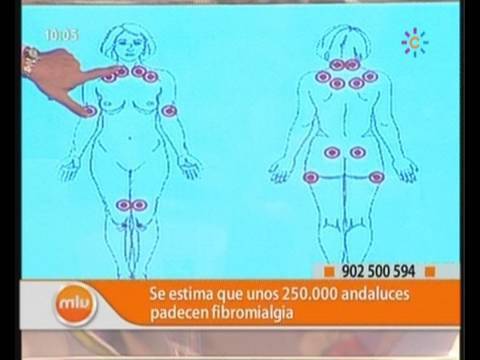 Vídeo: Puntos Sensibles De La Fibromialgia: Ubicaciones Y Consejos Para Hacer Frente