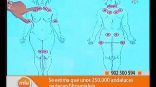 De detrás la cabeza puntos fibromialgia sensibles