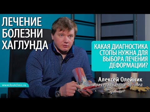 Какая диагностика стопы нужна для выбора лечения деформации Хаглунда? доктор Алексей Олейник