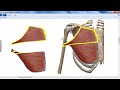 folding and twisting of pectoralis major muscle DR  SAMEH GHAZY