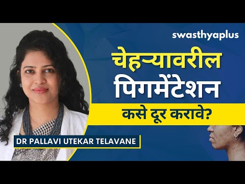 चेहऱ्यावरील पिगमेंटेशन: उपचार | What is Facial Pigmentation? in Marathi | Dr Pallavi Utekar Telavane
