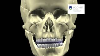 Asimetria Facial Cirugia Bimaxilar