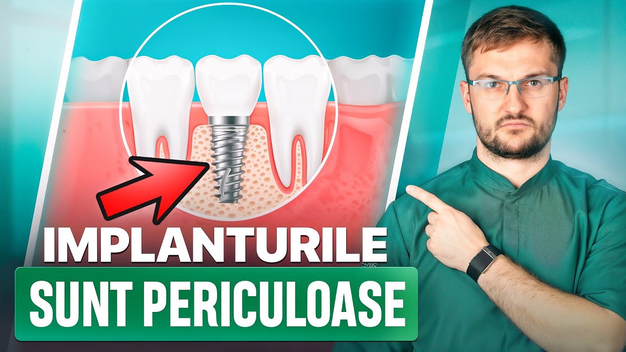 Nu-ți pune implanturi până nu privești acest video! Plusurile și minusurile implanturilor dentare…