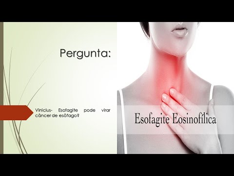 Vídeo: A esofagite pode causar câncer?