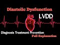 Diastolic Dysfunction | LVDD | Heart Failure | Echocardiography | Hindi | ECG | Science Plus