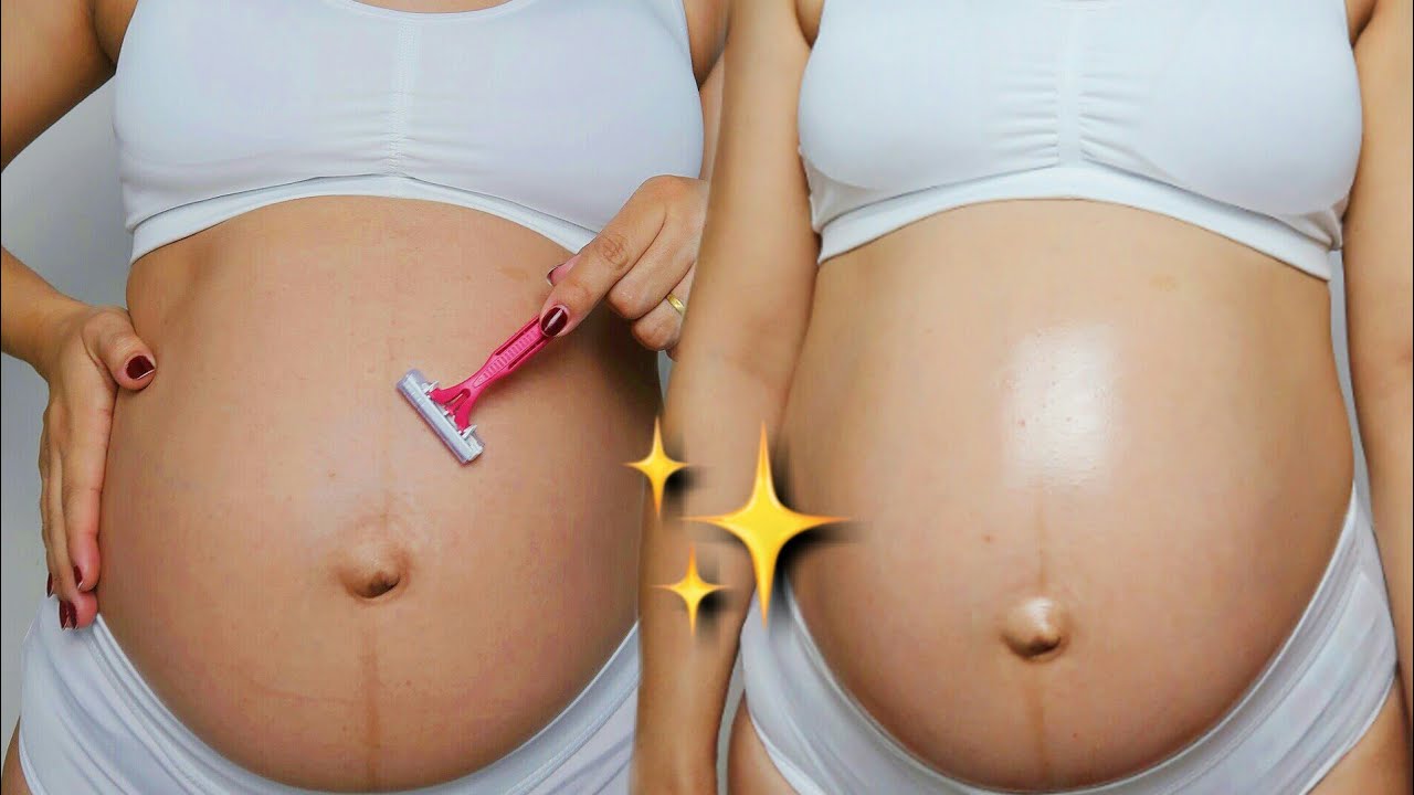 Autocuidado na GRAVIDEZ | para evitar ESTRIAS 💦