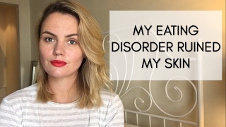 My Eating Disorder Ruined My Skin (with photo)