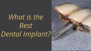 What is the best dental implant