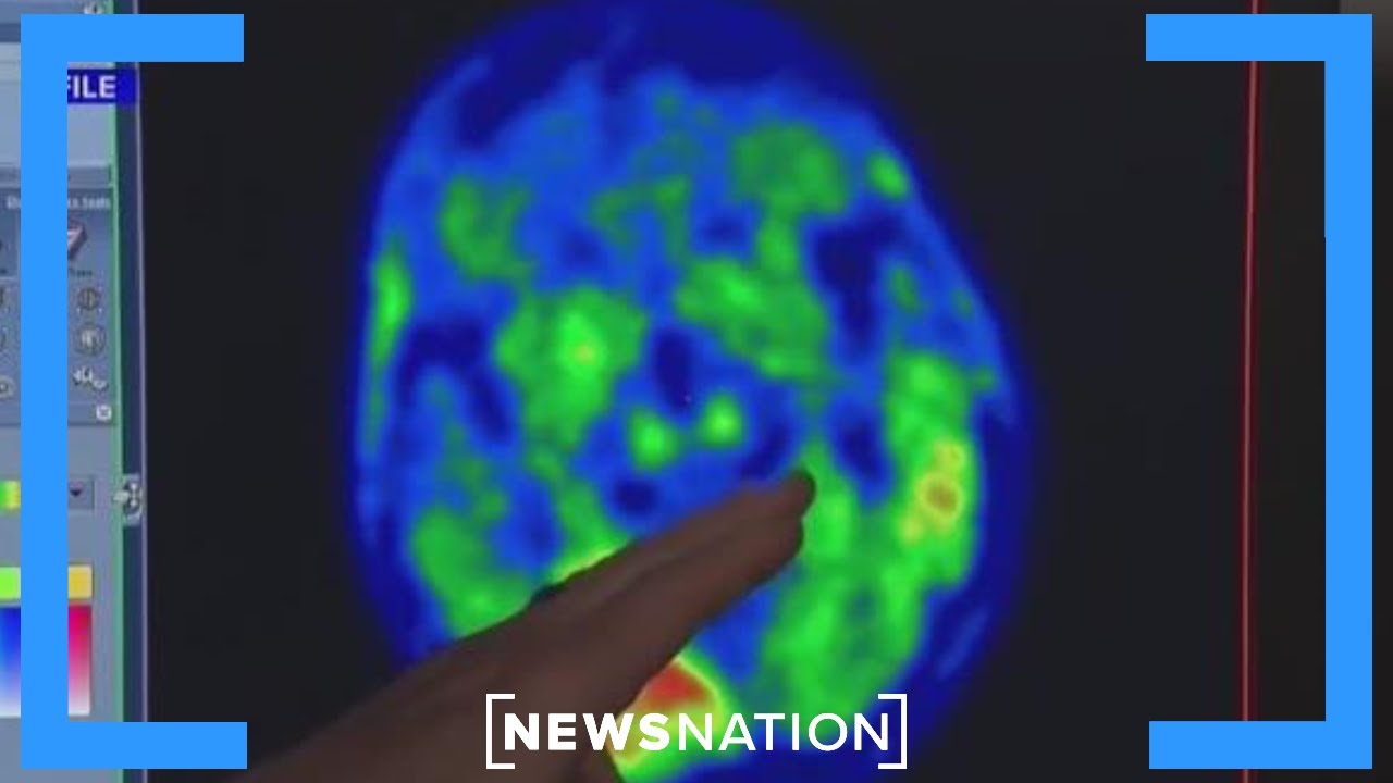 Lithium may reverse Alzheimer’s disease: Study | Elizabeth Vargas Reports