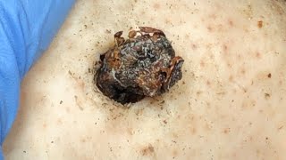 Download Lagu 𝑻𝒉𝒆 𝑩𝒆𝒔𝒕 𝑹𝒆𝒎𝒐𝒗𝒊𝒏𝒈 𝑫𝒊𝒓𝒕 𝑼𝒏𝒅𝒆𝒓 𝑻𝒉𝒆 𝑺𝒌𝒊𝒏 𝑰𝒔 𝑹𝒆𝒇𝒓𝒆𝒔𝒉𝒊𝒏𝒈 𝑨𝒏𝒅 𝑹𝒆𝒍𝒂𝒙𝒊𝒏𝒈 #90085354 MP3